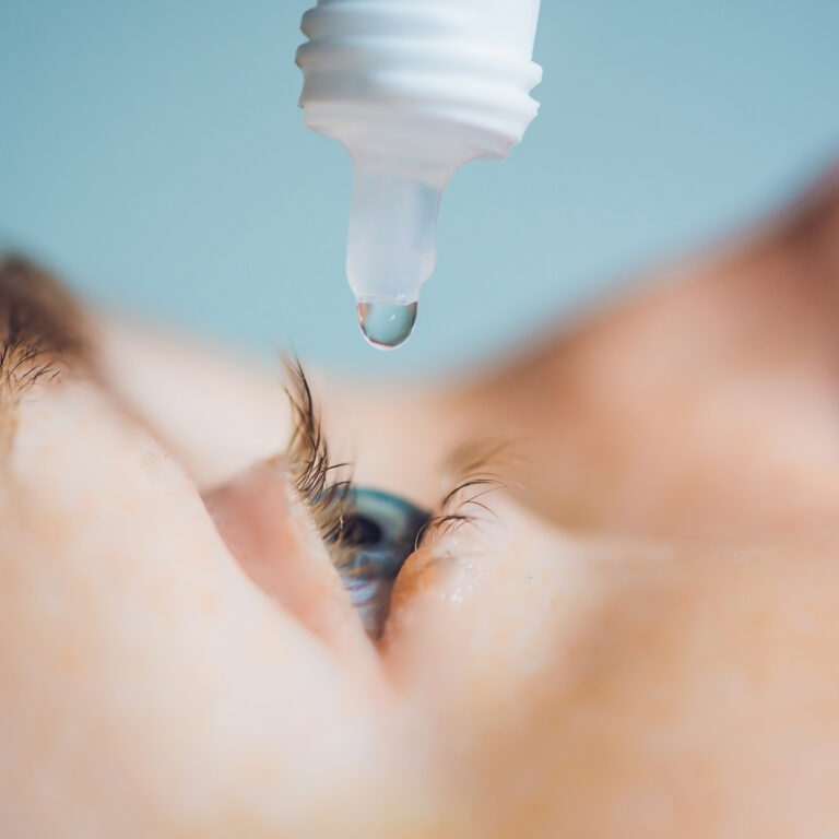 5. Feche e abra os olhos várias vezes, ao longo do dia, para lubrificar. Se não surtir efeito, recorra a gotas hidratantes para evitar o olho seco.